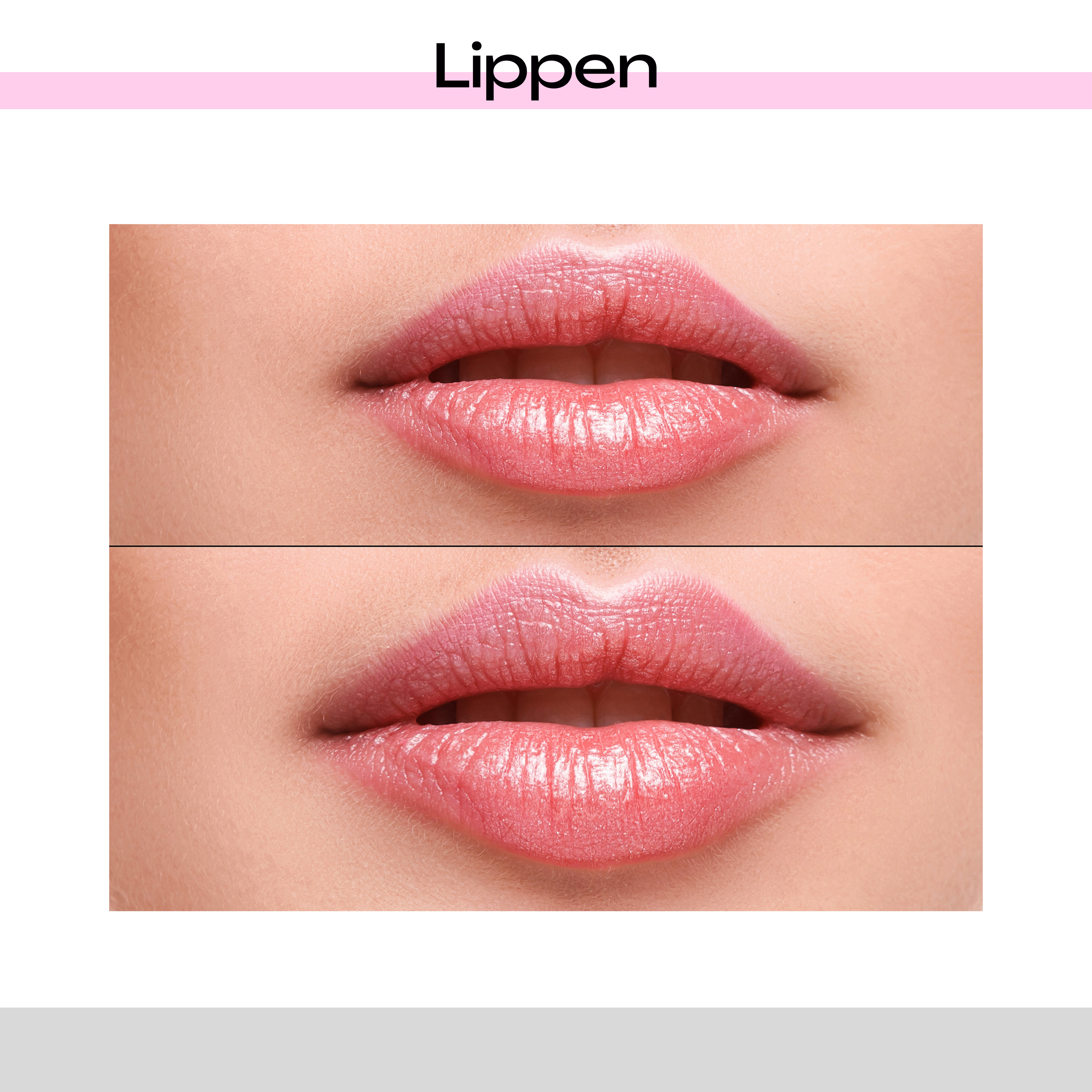 Lippen aufspritzen